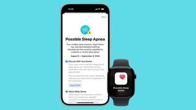 Apple Watch 睡眠呼吸暂停检测功能全球上线 Apple Watch 睡眠呼吸暂停检测功能全球上线