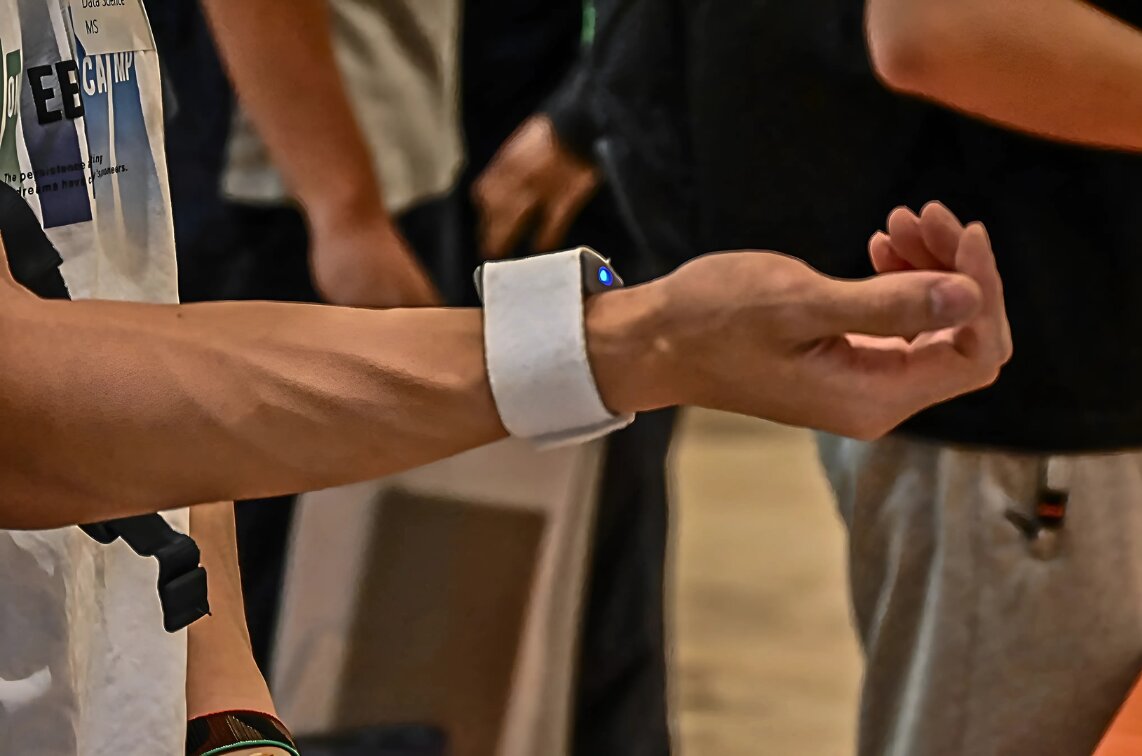 KOS AI 推出无创血糖监测设备 Argus，革新糖尿病护理