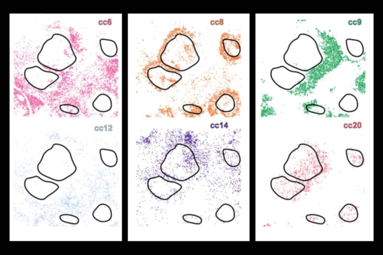 CellLENS:AI 技术精准绘制 3D 癌症图谱,开启肿瘤治疗新纪元 CellLENS:AI 技术精准绘制 3D 癌症图谱,开启肿瘤治疗新纪元