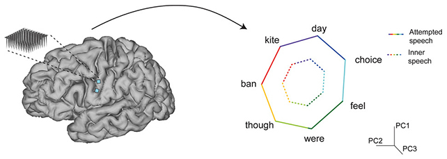 脑植入物突破:将思维直接转化为语音,准确率高达 74% 脑植入物突破:将思维直接转化为语音,准确率高达 74%