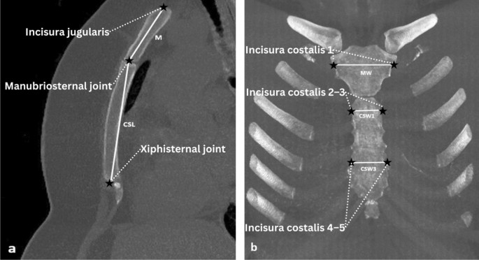 机器学习与深度神经网络在土耳其人群性别预测中的应用