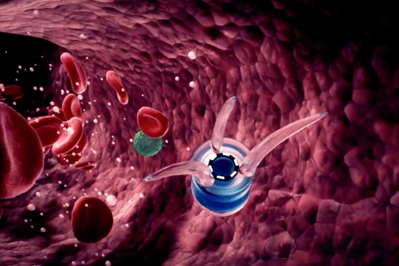 纳米机器人的未来：从科幻梦想到现实挑战