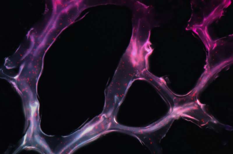 AI 新工具可无创预测口咽癌扩散风险，助力头颈癌精准治疗决策