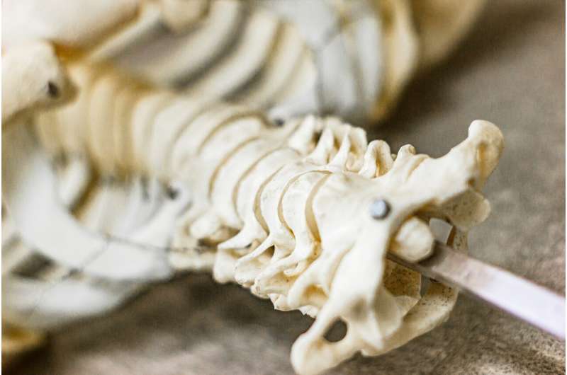 人工智能模型如何提升脊柱转移瘤治疗精准度？五大预测因子是关键